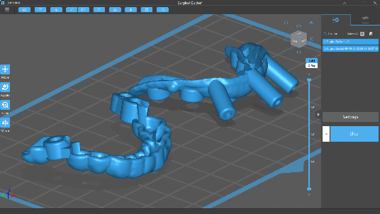 Software stampa 3d settore dentale