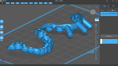 Soluzione Dentale Stampa 3d